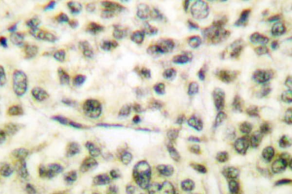 Polyclonal Rabbit anti-Human GSK3A / GSK3 Alpha Antibody (Gly273/120, IHC, WB)
