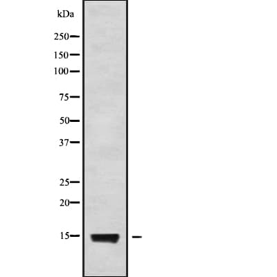 Polyclonal Rabbit anti-Human RABIF Antibody (IHC, IF, WB)