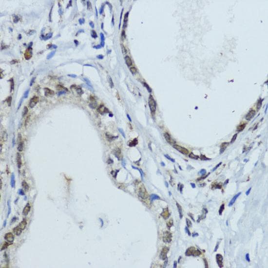 NR1I3 / CAR Antibody