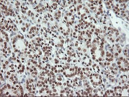 MSI1 / Musashi 1 Antibody (clone OTI2E9, Carrier-free)