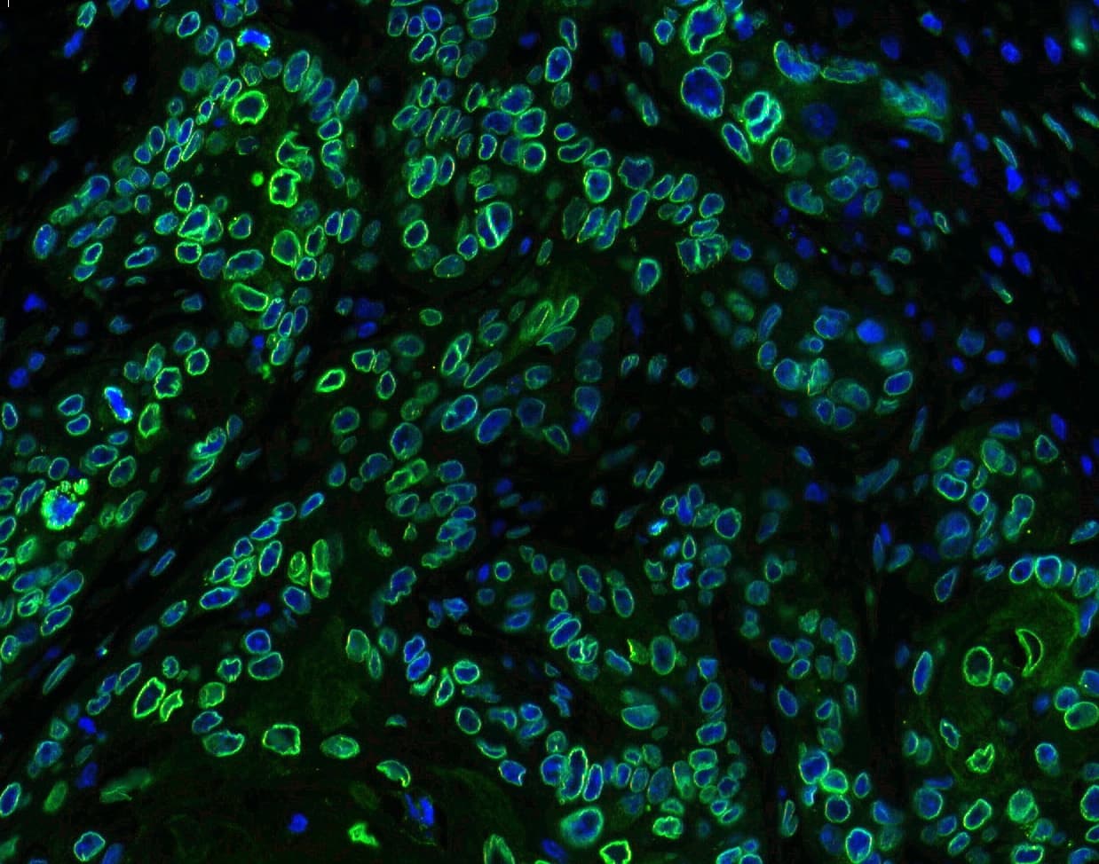 Polyclonal Rabbit anti-Human EMD / Emerin Antibody (IHC, WB)
