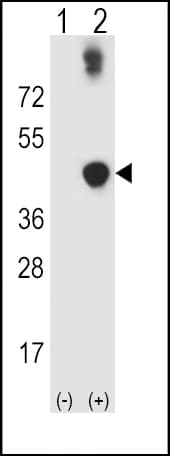 IHC-plus™ Polyclonal Rabbit anti-Human ADH5 Antibody (aa212-239, IHC, WB)