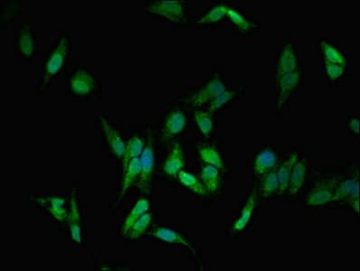 DLG1 / SAP97 Antibody