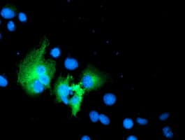 WWTR1 / TAZ Antibody (clone OTI1B5)