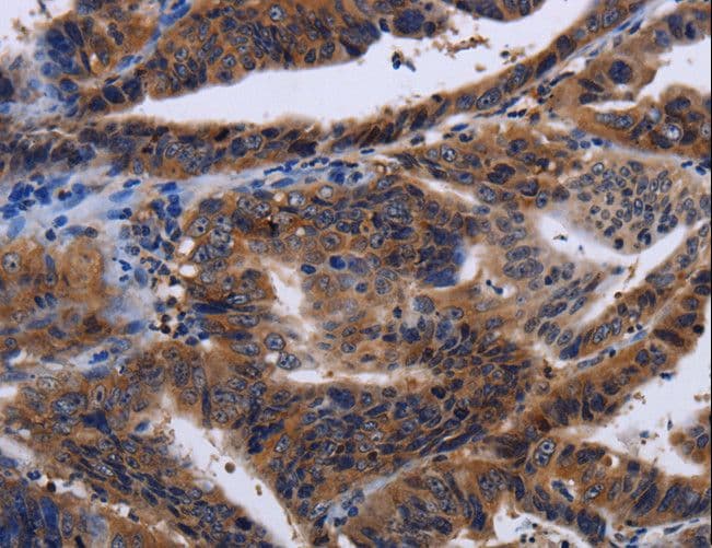 HTR2B / 5-HT2B Receptor Antibody