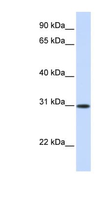 Polyclonal Rabbit anti-Human ATF5 Antibody (aa180-229, WB)