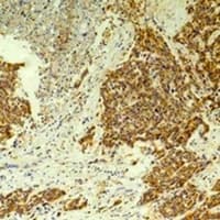 CLIC4 Antibody
