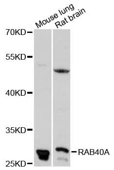RAB40A / RAR2 Antibody