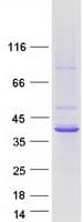 Human TMOD2 / Tropomodulin 2 Protein (Recombinant Myc-DDK (Flag))