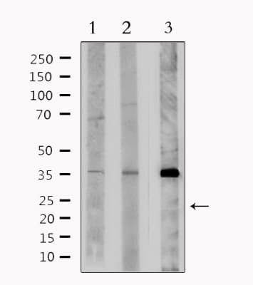 NIX / BNIP3L Antibody