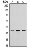 CTSA / Cathepsin A Antibody (Internal)