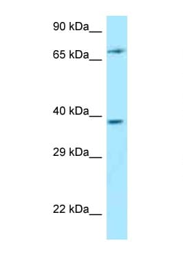 Polyclonal Rabbit anti-Human THEMIS / SPOT Antibody (C-Terminus, WB)