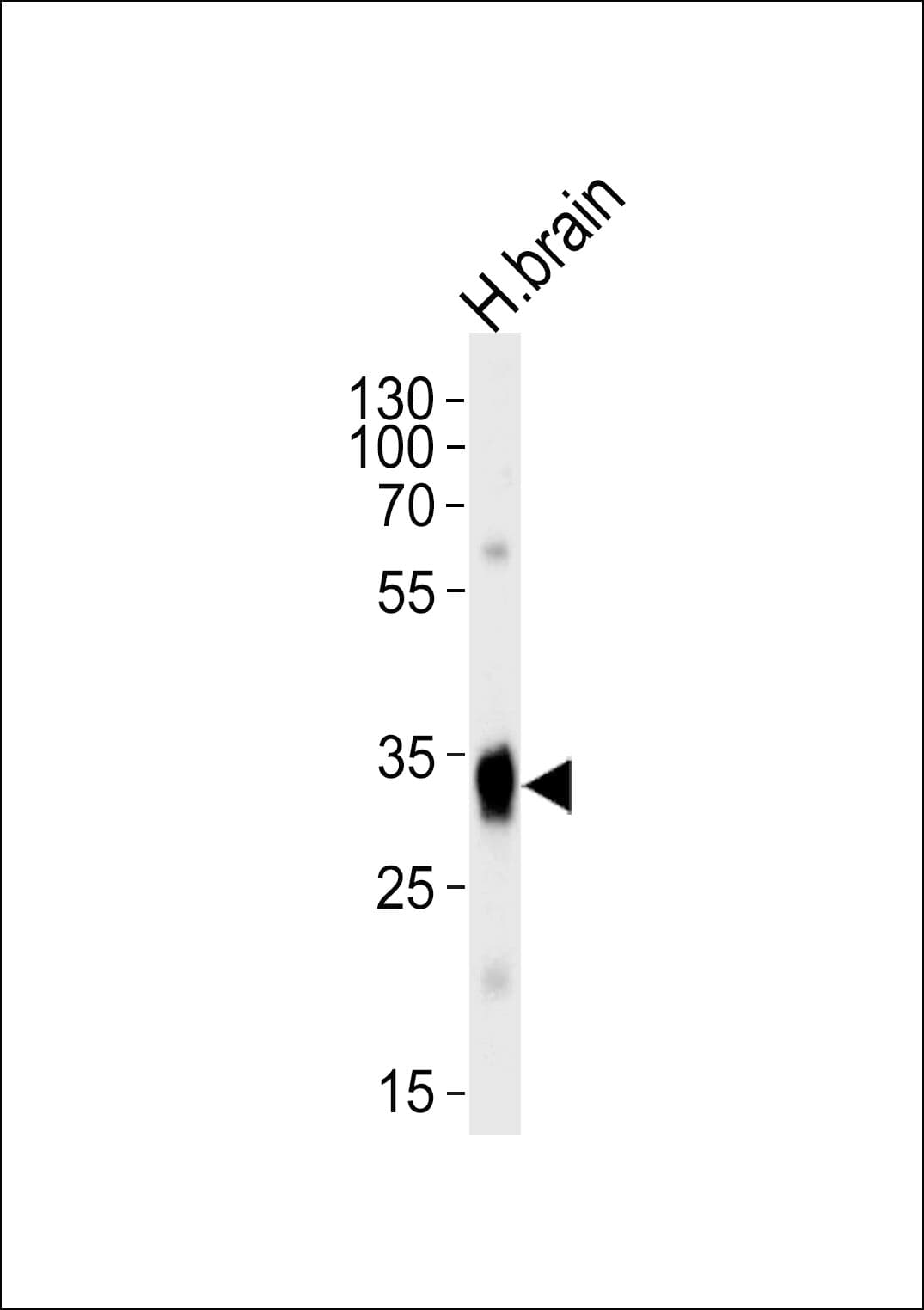 Polyclonal Rabbit anti-Human SULT4A1 / Sulfotransferase 4A1 Antibody (aa1-30, WB)
