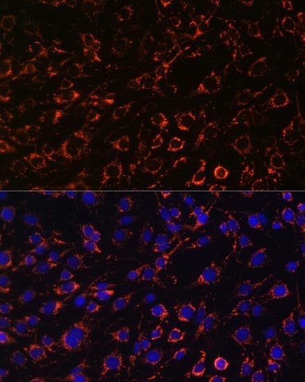Polyclonal Rabbit anti-Human TOMM20 Antibody (IHC, IF)