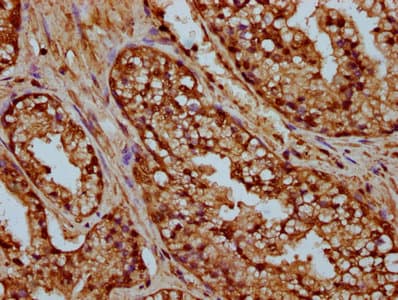 Polyclonal Rabbit anti-Human HIST1H4I Antibody (IHC, IF)