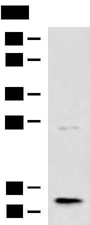TMEM141 Antibody