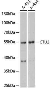 Polyclonal Rabbit anti-Human CTU2 Antibody (WB)