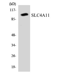SLC4A11 / NABC1 Antibody (aa276-325)