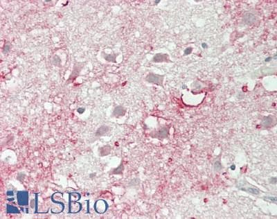 IHC-plus™ Polyclonal Rabbit anti-Human RAB35 Antibody (Internal, IHC, WB)
