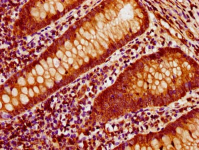 ACTB / Beta Actin Antibody