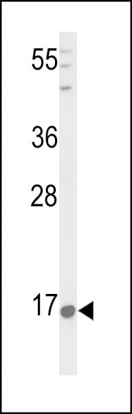 Polyclonal Rabbit anti-Human PNOC / Nociceptin Antibody (aa126-151, IHC, WB)