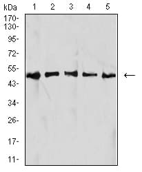 Monoclonal Mouse anti-Human IDH1 / IDH Antibody (clone 7G8A1, IHC, WB)