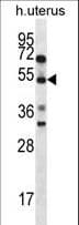 Polyclonal Rabbit anti-Human STARS / ABRA Antibody (aa275-304, IHC, WB)