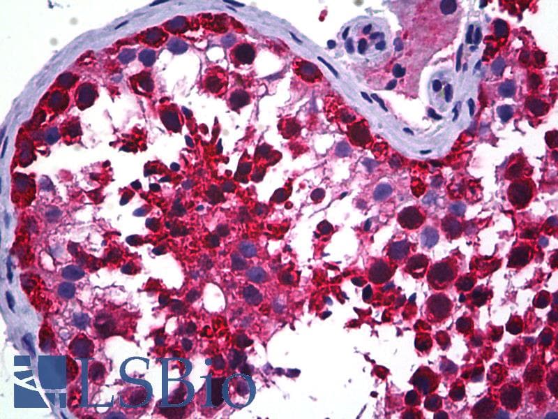 IHC-plus™ CCT5 / TCP1 Epsilon Antibody (clone 4E5-4B1)