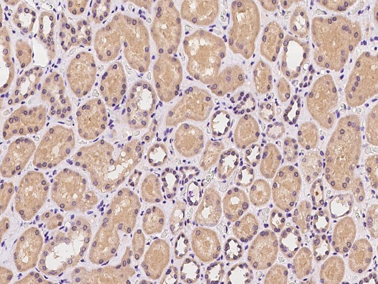 C6orf62 Antibody