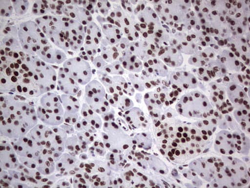 HDAC9 Antibody (aa181-460, clone OTI7G2, Carrier-free)
