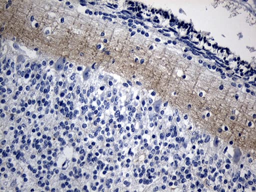 NEGR1 / Neurotractin Antibody (aa80-205, clone OTI3G8)