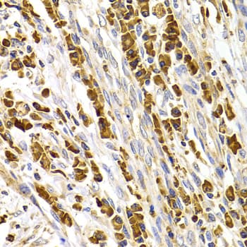 TACR3 / NK3R Antibody