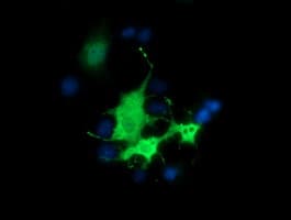 VMD2L3 / BEST3 Antibody (clone OTI3B11, Carrier-free)