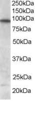 IHC-plus™ FOXO3 / FOXO3A Antibody (aa661-673)