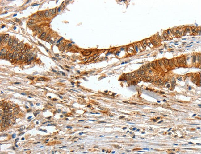 COL1A2 / Collagen I Alpha 2 Antibody