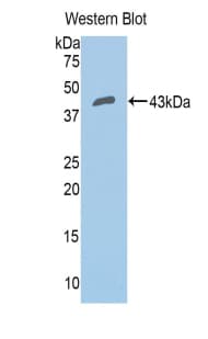 CFB / Complement Factor B Antibody (aa35-160)