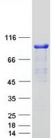 Human PALMD Protein (Recombinant Myc-DDK (Flag))