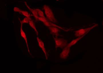 TP53 / p53 Antibody (phospho-Ser15)