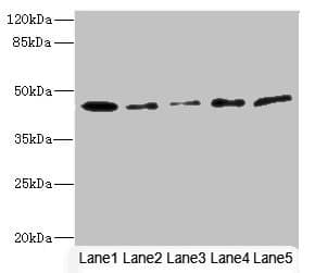 Polyclonal Rabbit anti-Human SIGIRR Antibody (IHC, WB)