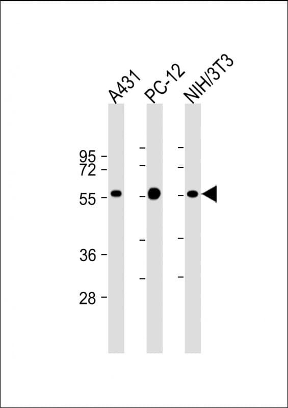 MITF Antibody (clone 1607CT834.207.47)