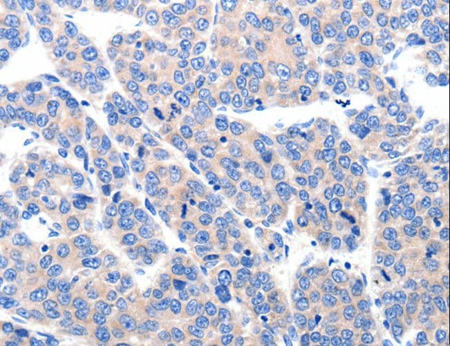 Polyclonal Rabbit anti-Human KCNH8 / ELK Antibody (IHC)