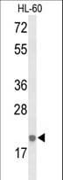 Polyclonal Rabbit anti-Human IL26 Antibody (aa88-115, WB)