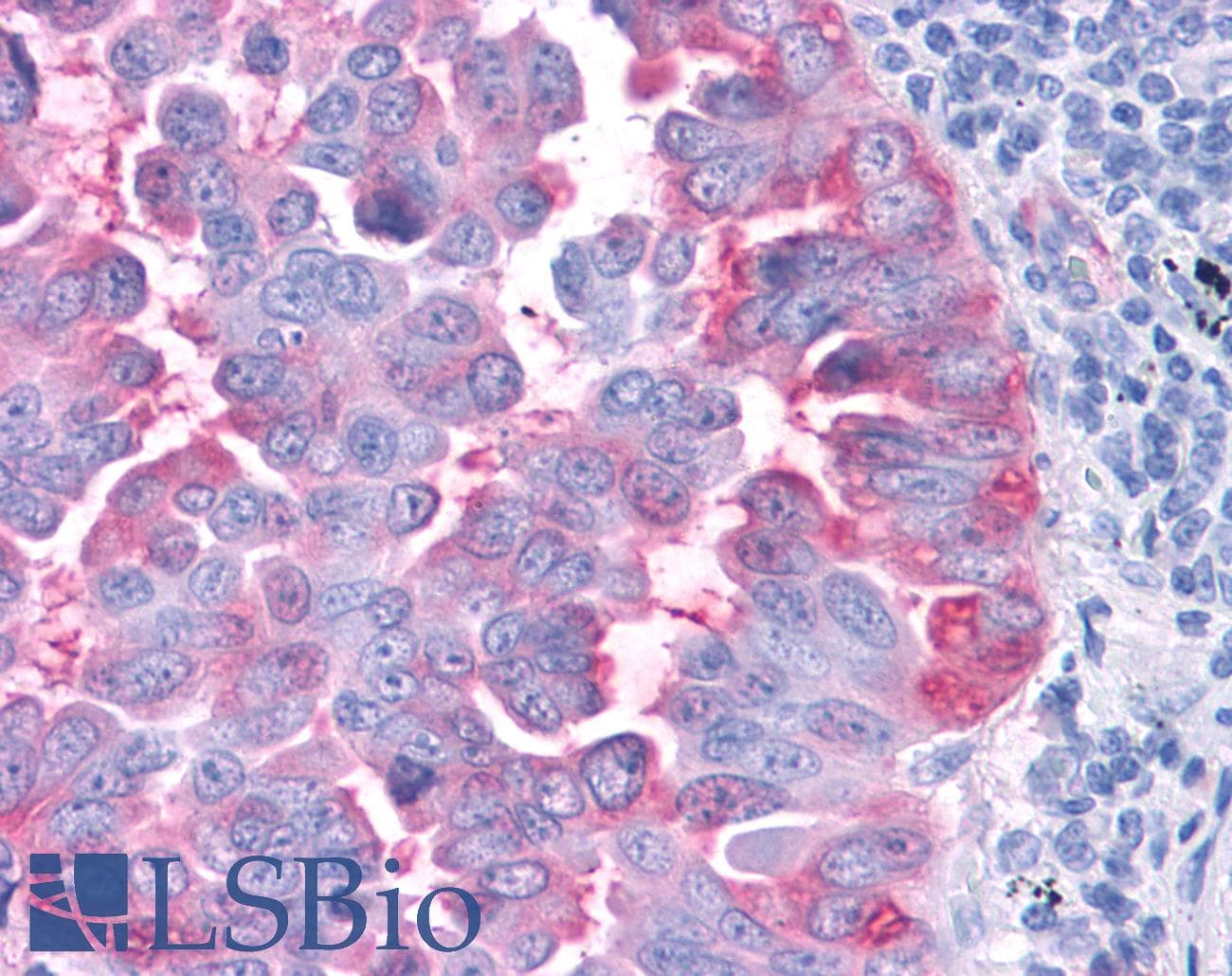 PathPlus™ CCR4 Antibody (C-Terminus)