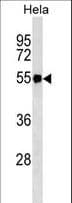 FGG / Fibrinogen Gamma Antibody (aa417-445)
