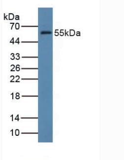 FDFT1 / Squalene Synthase Antibody (aa269-417, APC)
