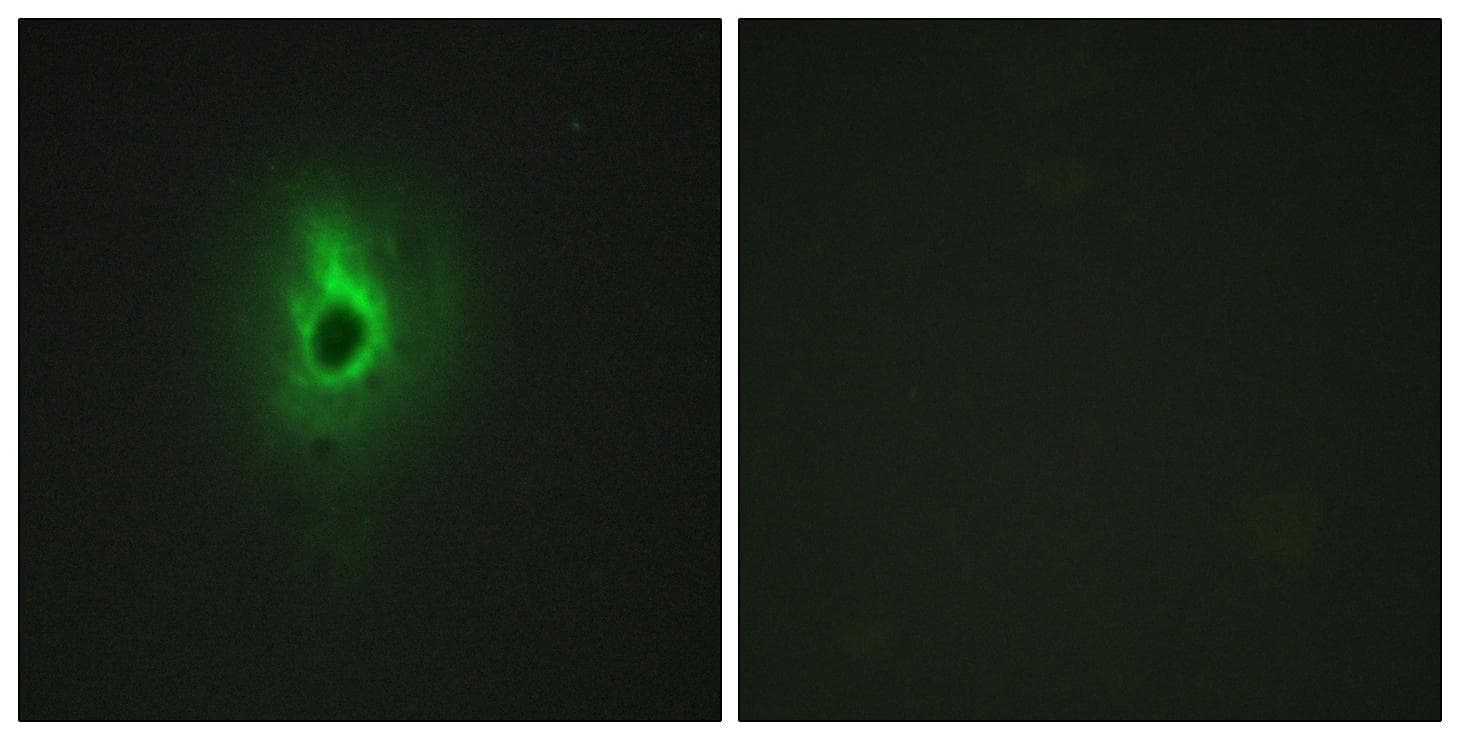 COL6A3 / Collagen VI Alpha 3 Antibody