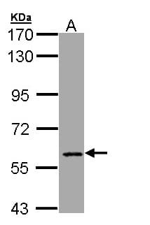 Polyclonal Rabbit anti-Human CBFA2T2 / MTGR1 Antibody (aa401-604, WB)