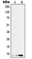 Polyclonal Rabbit anti-Human SF3B6 / SF3B14 Antibody (C-Terminus, IF, WB)