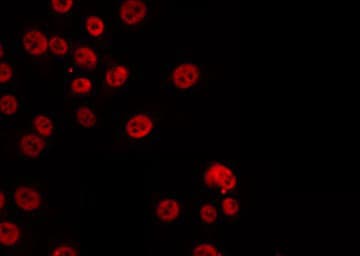 CARF / ALS2CR8 Antibody