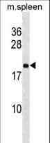 RPL9 / Ribosomal Protein L9 Antibody (aa103-131)